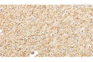 Immunohistochemistry (IHC) image for anti-Glutathione S-Transferase alpha 2 (GSTa2) (AA 1-222) antibody (ABIN7434407)