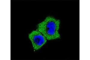 Fluorescent confocal image of A431 cells stained with SMAD7 antibody at 1:25. (SMAD7 抗体  (AA 195-224))