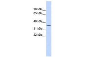 Image no. 1 for anti-Ficolin (Collagen/fibrinogen Domain Containing) 1 (FCN1) (AA 180-229) antibody (ABIN6743782) (FCN1 抗体  (AA 180-229))