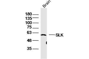 Mouse Brain lysates probed with SLK Polyclonal Antibody, Unconjugated  at 1:300 dilution and 4˚C overnight incubation. (SLK 抗体  (AA 165-270))