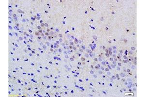 Formalin-fixed and paraffin embedded rat brain tissue labeled with Anti phospho-MAP3K9+MAP3K10(Thr312+Thr266) Polyclonal Antibody, Unconjugated  at 1:200 followed by conjugation to the secondary antibody and DAB staining (MAP3K9 抗体  (pThr312))