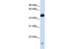 WB Suggested Anti-KCMF1 Antibody Titration:  0. (KCMF1 抗体  (C-Term))