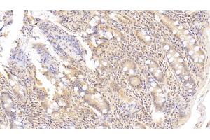 Detection of AXIN in Human Small intestine Tissue using Polyclonal Antibody to Axis Inhibition Protein (AXIN) (Axin 抗体  (AA 653-862))