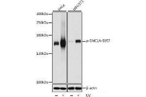 Western blot analysis of extracts of various cell lines using Phospho-SMC1A(S957) Polyclonal Antibody at dilution of 1:1000. (SMC1A 抗体  (pSer957))
