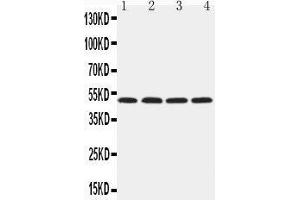 Western Blotting (WB) image for anti-Hyaluronidase-1 (HYAL1) (AA 32-47), (N-Term) antibody (ABIN3043999)