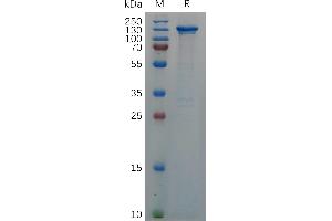 Human CD93 Protein, hFc Tag on SDS-PAGE under reducing condition