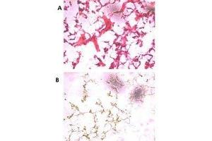 (A) H&E staining of frozen human ovarian cancer tissue with UCH37 antibody at 1:250. (UCHL5 抗体  (AA 56-87))