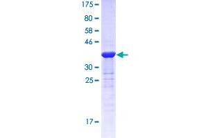 Image no. 1 for Growth Differentiation Factor 5 (GDF5) (AA 28-127) protein (GST tag) (ABIN2565080)