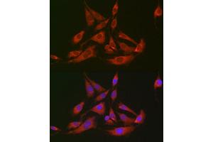Immunofluorescence analysis of BALB-3T3 cells using GOT2 antibody (ABIN6131312, ABIN6141285, ABIN6141286 and ABIN6222651) at dilution of 1:100 (40x lens). (GOT2 抗体  (AA 30-200))