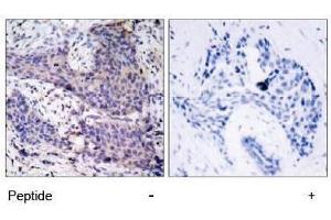 Image no. 1 for anti-BCL2-Associated Agonist of Cell Death (BAD) (Ser136) antibody (ABIN197210)