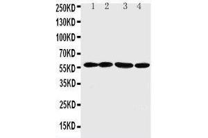Anti-ANGPTL1 antibody, Western blotting Lane 1: A549 Cell Lysate Lane 2: SW620 Cell Lysate Lane 3: MCF-7 Cell Lysate Lane 4: MM231 Cell Lysate (ANGPTL1 抗体  (C-Term))