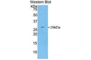 Western Blotting (WB) image for anti-Integrin alpha D (ITGAD) (AA 879-1099) antibody (ABIN3208930) (ITGAD 抗体  (AA 879-1099))