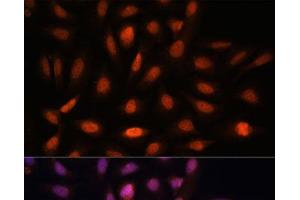 Immunofluorescence analysis of U-2 OS cells using PPIL4 Polyclonal Antibody at dilution of 1:100. (PPIL4 抗体)