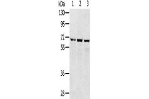 Gel: 8 % SDS-PAGE, Lysate: 40 μg, Lane 1-3: 293T cells, hepg2 cells, A172 cells, Primary antibody: ABIN7192509(SLC5A9 Antibody) at dilution 1/300, Secondary antibody: Goat anti rabbit IgG at 1/8000 dilution, Exposure time: 1 minute (SLC5A9 抗体)