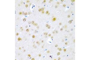 Immunohistochemistry of paraffin-embedded rat brain using TUSC2 antibody at dilution of 1:200 (40x lens). (TUSC2 抗体)