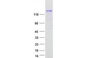 Western Blotting (WB) image for CDKN1A Interacting Zinc Finger Protein 1 (CIZ1) (Transcript Variant 1) protein (Myc-DYKDDDDK Tag) (ABIN2714205)