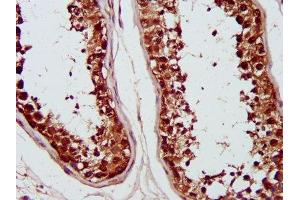 IHC image of ABIN7142226 diluted at 1:1200 and staining in paraffin-embedded human testis tissue performed on a Leica BondTM system.