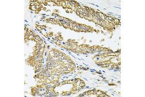 Immunohistochemistry of paraffin-embedded human prostate using HLA-DQA1 antibody. (HLA-DQA1 抗体  (AA 24-216))