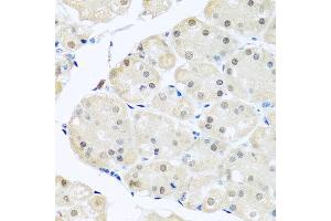 Immunohistochemistry of paraffin-embedded human stomach using DNAL1 antibody at dilution of 1:100 (x40 lens). (DNAL1 抗体)