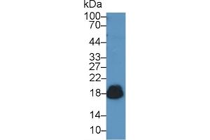 Detection of CD59 in Human Urine using Polyclonal Antibody to Cluster of Differentiation 59 (CD59) (CD59 抗体  (AA 23-105))