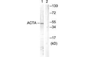 Western blot analysis of extracts from mouse brain cells, using Actin-pan ( alpha/gamma)  (Ab-55/53) Antibody. (Actin 抗体  (AA 21-70))