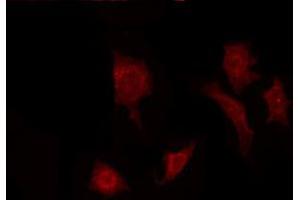 ABIN6272299 staining Hela by IF/ICC. (FGF22 抗体  (Internal Region))