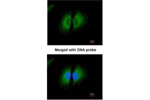 ICC/IF Image Immunofluorescence analysis of paraformaldehyde-fixed HeLa, using Kininogen-1, antibody at 1:200 dilution. (KNG1 抗体)