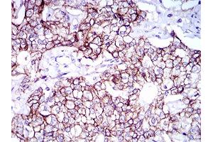 Immunohistochemistry (IHC) image for anti-Activated Leukocyte Cell Adhesion Molecule (ALCAM) (AA 48-216) antibody (ABIN1724867)
