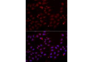 Immunofluorescence analysis of HeLa cells using CST2 antibody (ABIN5973947). (CST2 抗体)