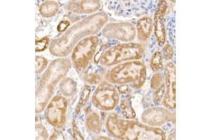 Immunohistochemistry of paraffin-embedded rat kidney using MMP14/MT1-MMP Rabbit pAb (ABIN3023354, ABIN3023355, ABIN3023356 and ABIN6219646) at dilution of 1:100 (40x lens). (MMP14 抗体)