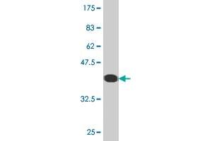Western Blot detection against Immunogen (36. (FHL1 抗体  (AA 23-120))