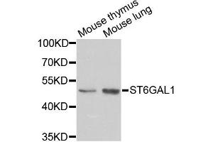 Western blot analysis of extracts of various cell lines, using ST6GAL1 antibody (ABIN5973377) at 1/1000 dilution. (ST6GAL1 抗体)