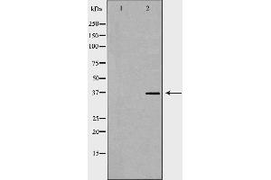 Western blot analysis of Jurkat whole cell lysates, using ACP5 Antibody. (ACP5 抗体  (N-Term))