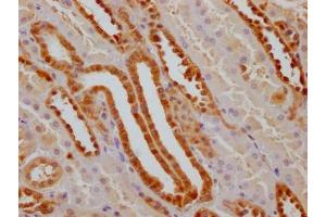 IHC image of ABIN7127532 diluted at 1:100 and staining in paraffin-embedded human kidney tissue performed on a Leica BondTM system. (Recombinant GSTP1 抗体)