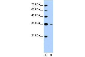 Granzyme H antibody used at 2. (GZMH 抗体)