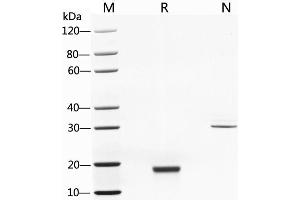 SDS-PAGE (SDS) image for Colony Stimulating Factor 1 (Macrophage) (CSF1) (AA 33-190), (Isoform 3) (Active) protein (ABIN2018212)