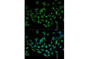 Immunofluorescence analysis of MCF7 cell using CDKN3 antibody. (CDKN3 抗体  (AA 1-172))