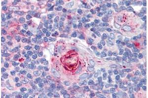 Human Thymus (formalin-fixed, paraffin-embedded) stained with ICAM1 antibody ABIN298517 at 10 ug/ml followed by biotinylated anti-mouse IgG secondary antibody ABIN481714, alkaline phosphatase-streptavidin and chromogen. (ICAM1 抗体)