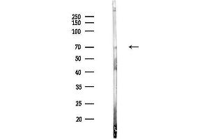 Western blot analysis of lysates from Rat testis, using Phospho-NF-kB p65 (Ser529) Antibody at 1/1000 dilution.