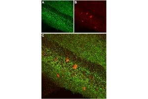 Expression of CB1 receptor in mouse hippocampus - Immunohistochemical staining of mouse hippocampus using Anti-Cannabinoid Receptor 1 (extracellular) Antibody (ABIN7043023, ABIN7044155 and ABIN7044156), (1:100). (CNR1 抗体  (Extracellular, N-Term))