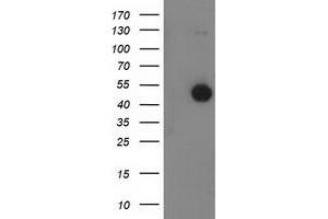 Western Blotting (WB) image for anti-Beclin 1, Autophagy Related (BECN1) antibody (ABIN1496868) (Beclin 1 抗体)