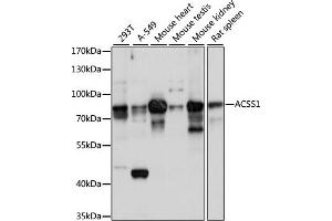 Western blot analysis of extracts of various cell lines, using  antibody (ABIN7265426) at 1:1000 dilution. (ACSS1 抗体  (AA 340-689))