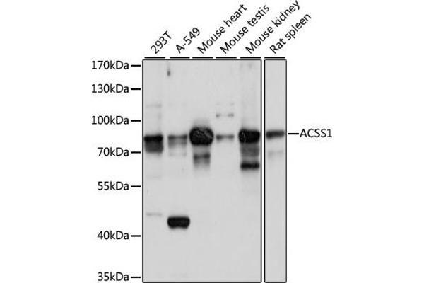 ACSS1 抗体  (AA 340-689)