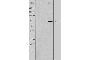 Western blot analysis of extracts from HuvEc cells, using CLCNKA antibody. (CLCNKA 抗体  (C-Term))