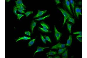 Immunofluorescence staining of Hela Cells with ABIN7127560 at 1:50, counter-stained with DAPI. (Recombinant ID1 抗体)