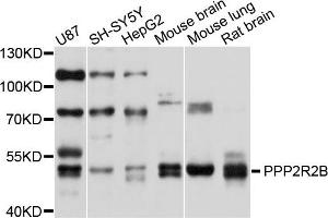 Western blot analysis of extracts of various cells, using PPP2R2B antibody. (PPP2R2B 抗体)