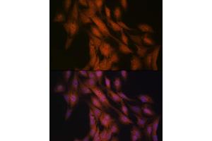 Immunofluorescence analysis of C6 cells using Gli3 Rabbit mAb (ABIN7267385) at dilution of 1:100 (40x lens). (GLI3 抗体)
