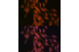 Immunofluorescence analysis of C6 cells using Gli3 Rabbit mAb (ABIN7267385) at dilution of 1:100 (40x lens). (GLI3 抗体)
