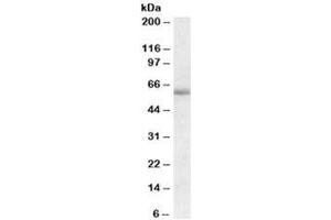 Western blot testing of human amygdala lysate with Cadherin 23 antibody at 1ug/ml. (CDH23 抗体)