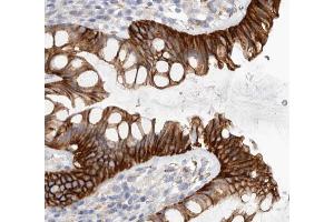 Immunohistochemistry (IHC) image for anti-Catenin (Cadherin-Associated Protein), beta 1, 88kDa (CTNNB1) (N-Term) antibody (ABIN6260494)